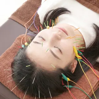 美容鍼DAZZLE マスザキのエステ・リラクイメージ