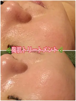 Dione 立川店のエステ・リラクイメージ