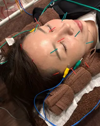 小林整骨院本町 美容鍼roomのエステ・リラクイメージ