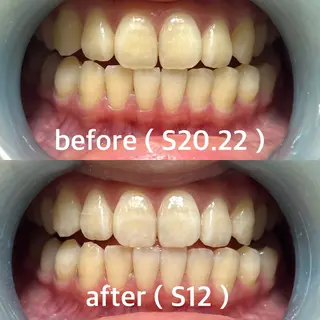 メンズ 九州オーラルホワイトニング所属・田中 毬亜/薬院警固店のエステ・リラクイメージ