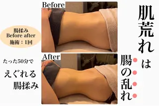 脱毛&フェイシャル 専門店muro.のエステ・リラクイメージ