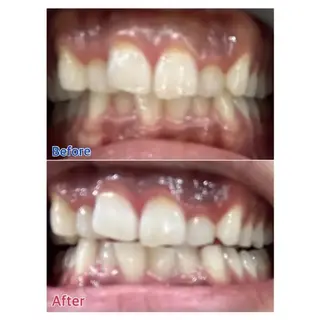 Ｍ渋谷 ホワイトニングのエステ・リラクイメージ