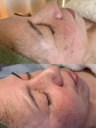 肌に自信のない人 専門サロンのエステ・リラクイメージ