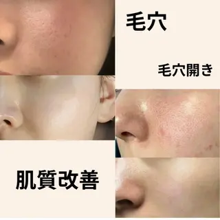 マツエク・マツパ 愛維美水光美肌専門店所属・愛維美水光美肌専門店 メンズレディースokのエステ・リラクイメージ