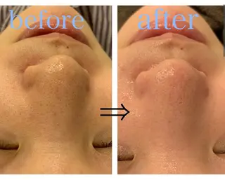 Rejuve ﾘｼﾞｭﾍﾞのエステ・リラクイメージ