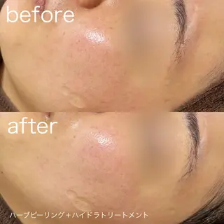 lulularico Yuのエステ・リラクイメージ