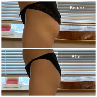 private salon AZU所属・AZU 小林朋美のエステ・リラクイメージ