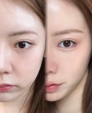 カラー aliaハイフ&水光ジェットサロン所属・aliaハーブ水光店 エステティシャン募集のエステ・リラクイメージ