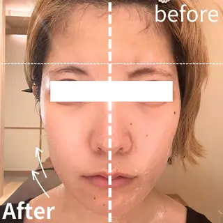 美BARI新宿店 RINAのエステ・リラクイメージ