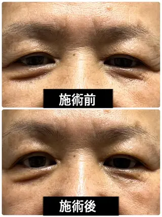 小顔と腸の専門店 ラクーラビューティのエステ・リラクイメージ