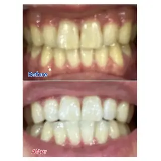 M渋谷 ホワイトニングのエステ・リラクイメージ