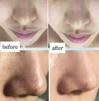 エンダモロジー BINOSUのエステ・リラクイメージ