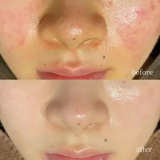 韓国肌管理・肌質改善 EARNEST心斎橋のエステ・リラクイメージ