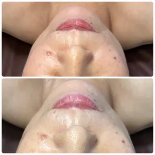 肌育脱毛サロン LikoLinaのその他イメージ