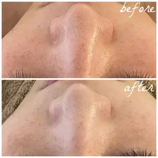 メンズ メナード岐阜茜部 杉浦のエステ・リラクイメージ