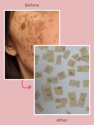 ELEGANCE所属・メンズ脱毛サロン BRIGHTのエステ・リラクイメージ