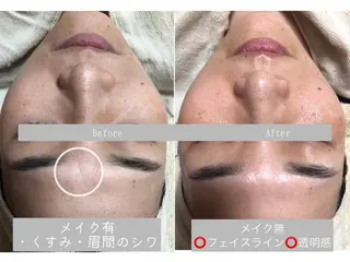エステサロン monicoの眉毛・アイブロウイメージ
