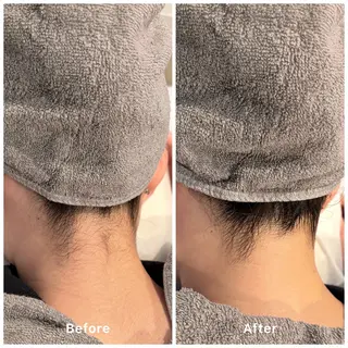 ✨韓国肌管理✨ Lisaのエステ・リラクイメージ