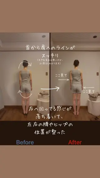 肩こり・巻き肩・姿勢 ・小顔|大阪西区のエステ・リラクイメージ