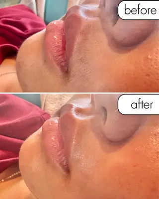 蝶式糸除毛専門salon aco所属・糸除毛専門salon acoのエステ・リラクイメージ