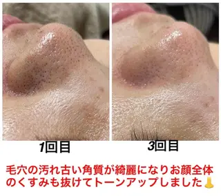 ネイル・エステサロン UILANIのネイルデザイン