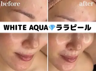 WHITE AQUA 🌼柏店のエステ・リラクイメージ