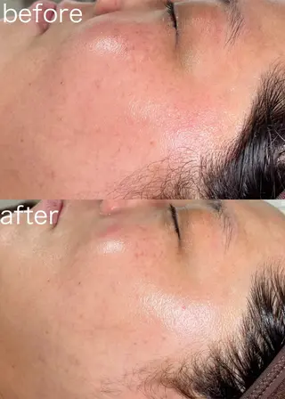 医療提携Beauty SalonMuseのエステ・リラクイメージ