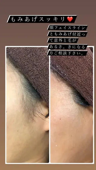 美肌脱毛fuu okinawa所属・宜野湾美肌脱毛fuu okinawaタイラのエステ・リラクイメージ