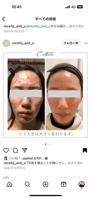 上坂 祐以のエステ・リラクイメージ