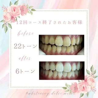 セルフホワイトニング Dolce八王子店のその他イメージ