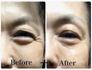 首肩こり専門サロン Kalnicco/カルニッコ所属・Kalnicco (カルニッコ)のエステ・リラクイメージ