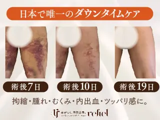 refiel たまプラーザ店所属・藤井 りさのエステ・リラクイメージ