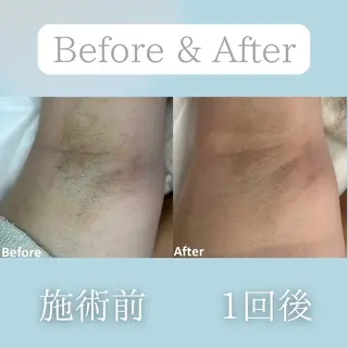 美肌脱毛&毛穴専門 Nico🐰ྀི♡のエステ・リラクイメージ