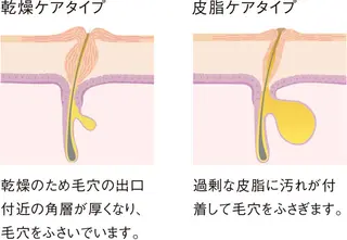 POLA松原店 岡本のエステ・リラクイメージ