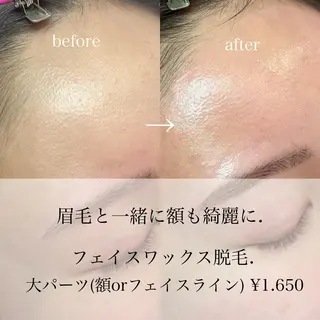 アイブロウ Lea堺東　毛穴洗浄 ×顔ワックス脱毛のその他イメージ