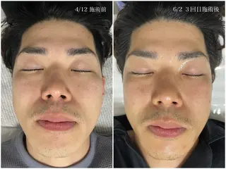 エステサロン sirokaのエステ・リラクイメージ