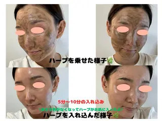 VIKI BEAUTY  クレイハーブピーリング・美肌脱毛専門店所属・VIKI BEAUTYのエステ・リラクイメージ