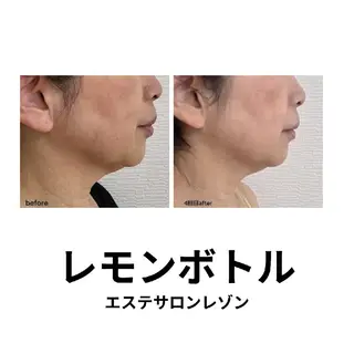 〈ニキビケアサロン〉 レゾン京橋店/ 浅川のエステ・リラクイメージ