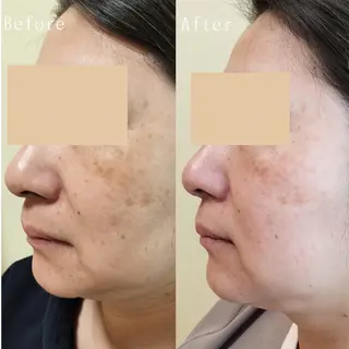 近藤 みさきのエステ・リラクイメージ