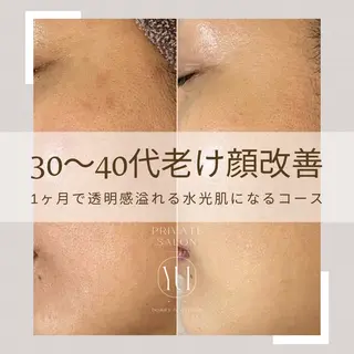 1ヶ月後も半分残る 高持続LEDエクステのマツエク・マツパデザイン