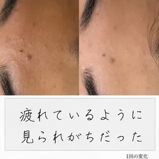 ニキビ経験者が施術 する専門サロン🌻のエステ・リラクイメージ