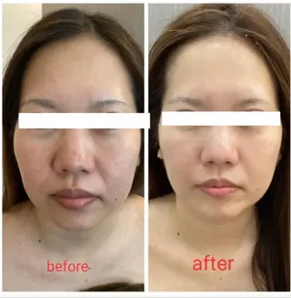 痩身/肌改善/脱毛 /リラク/MoaNaのエステ・リラクイメージ