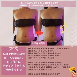 痩身ハーブピーリング 筋膜リリース☆B&Hのエステ・リラクイメージ