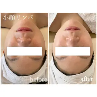 肌質改善／ブライダル I'm.-イム-のエステ・リラクイメージ