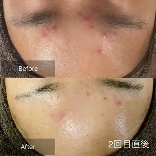 メンズ キッズ 美肌と癒しのサロン Lu,Mieのエステ・リラクイメージ