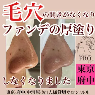 LULU ルルのエステ・リラクイメージ