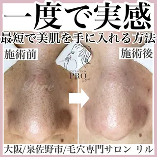 隅田 都布子のマツエク・マツパデザイン