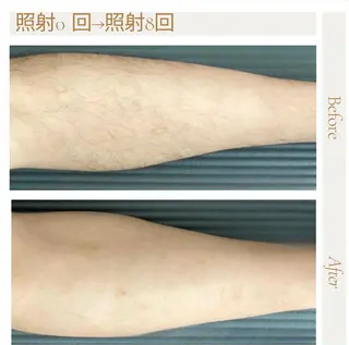 ピーリング＆脱毛 maoのエステ・リラクイメージ