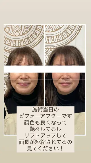 あだち整体エステ 首肩背中のゆるめぐのエステ・リラクイメージ