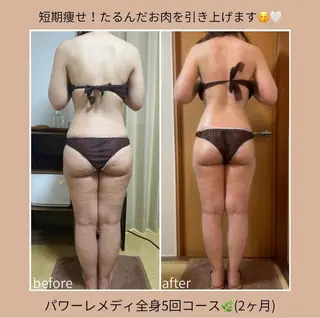 《本気痩せ×疲労改善 》  BILOOPのエステ・リラクイメージ